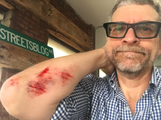 Kuntzman shows off his Flushing Avenue tattoo. Photo: Streetsblog