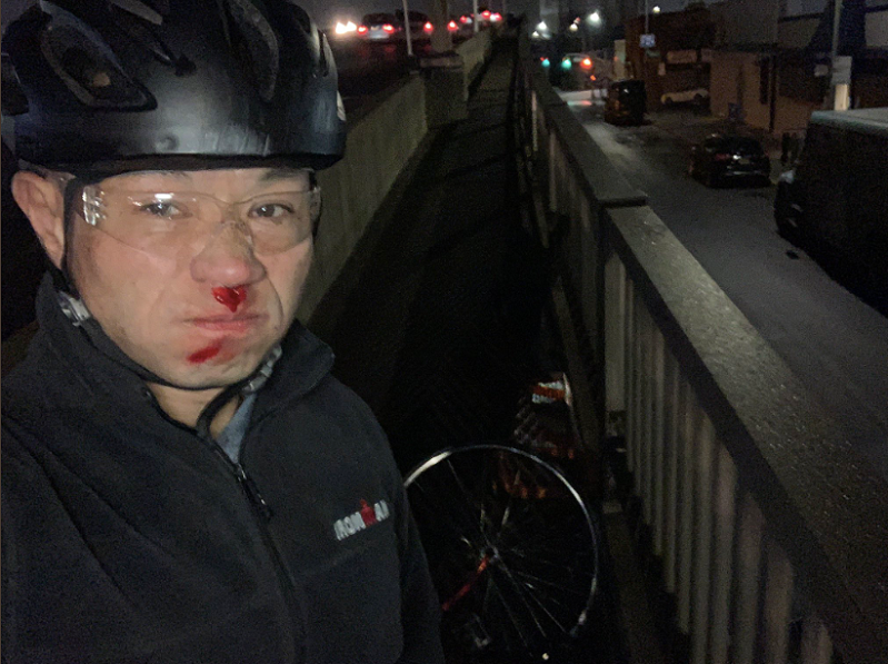 State Senator John Liu was bloodied in a bike crash on Northern Boulevard after hitting a huge piece of debris on a dark path. Photo: John Liu