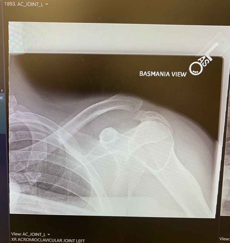 No, it is as bad as it looks.